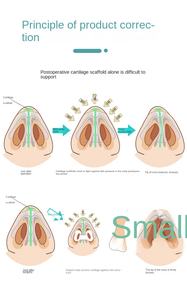 Pont nasal lisseur correcteur <span class=keywords><strong>nez</strong></span> Shaper Clip up levage doux sécurité Silicone rhinoplastie pour large <span class=keywords><strong>nez</strong></span> tordu Nasal - Product Image 4