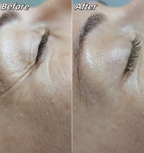 C Hàn Quốc Sản Xuất Mịn Vẻ Đẹp & Chăm Sóc Cá Nhân Công Cụ 20Pcs Fox Eye Dây Đúc Dòng Chủ Đề Mô Hình - Product Image 4