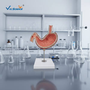 Modelli Anatomici per l'Insegnamento Medico: Modello di Stomaco con <span class=keywords><strong>Ulcere</strong></span>, Modello Anatomico del Sistema Digestivo - Product Image 5