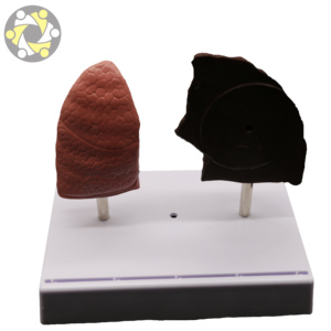 मानव फेफड़े चिकित्सा शिक्षण एनाटॉमी मॉडल - Product Image 4
