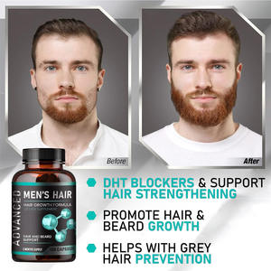 LUVVITA Vitaminas para el Crecimiento del Cabello Personalizadas al por Mayor, Suplementos Herbales Veganos Orgánicos Naturales para Hombres, <span class=keywords><strong>Adolescentes</strong></span> y Adultos - Product Image 2
