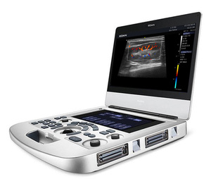 Ecógrafo Doppler Color Portátil Ligero Edan AX3 para Exámenes Vasculares, Obstétricos/Ginecológicos y Cardíacos - Product Image 3