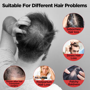 USB充電48PCS660nm & 460nm赤と青の光療法LED育毛キャップ - Product Image 3