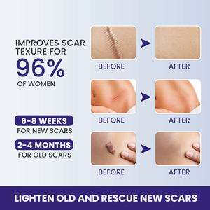 Scar Gel Safe and Effective Smooth Plump Scars Gel pour les soins du visage et du corps - Product Image 5