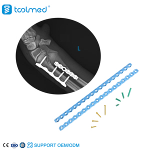 TOOLMED 수의사 ALPS 티타늄 재건 압축 잠금 플레이트 동물 애완 동물 정형 외과 용 동물 소모품 - Product Image 1