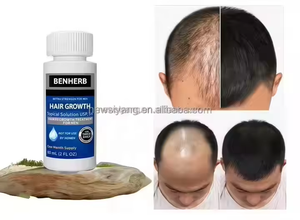 5% ้ำมันสำหรับใบหน้าเคราแบบ2-in-1เซรั่มบำรุงและลดการหลุดร่วงของเส้นผมสินค้ามาใหม่ช่วยเพิ่มการเติบโตของเส้นผมศีรษะล้าน - Product Image 5