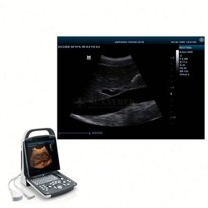 Instrumento de ultrasonido médico DP20 2D Color Doppler Ultrasonido Uso humano Digital <span class=keywords><strong>Mindray</strong></span> BW Ultrasonido - Product Image 4