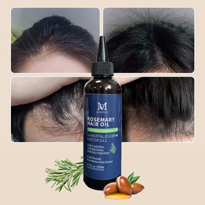 OEM Private Label 200ml Haarwuchsöl Haarvitalitäts-Booster Kopfhaut-Reparatur Kräuter-Rosmarin Haarwuchsöl Sanftes Haarwuchsöl - Product Image 1
