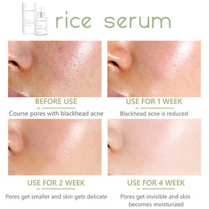 BLIW özel etiket en organik doğal pirinç kepeği özü siyah nokta Remover besleyici nemlendirici pirinç Serum yüz bakımı için - Product Image 4