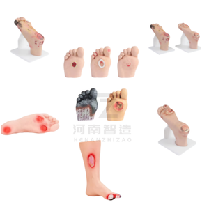 Modello didattico del piede diabetico, Modello del piede per infermieristica, Modello patologico - Product Image 1