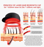 Casque de repousse des cheveux à 272 diodes, laser rouge pour la croissance des cheveux, traitement de la perte de cheveux, laser de faible intensité