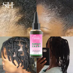 Snelle Snelheid Organische Rozemarijn Karkar Olie Haargroei Producten Verbetert Natuurlijke Haargroei Haartextuur Chebe Karkar Olie Voor Haar