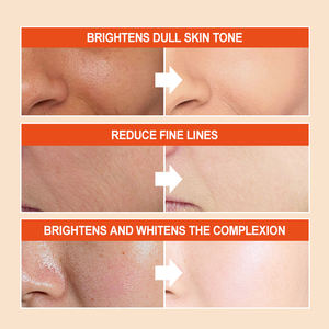 سيروم فيتامين سي طبيعي وعضوي مضاد للتجاعيد ومرطب ومزيل للبقع الداكنة ومبيض للبشرة، الأكثر مبيعًا بعلامة تجارية خاصة - Product Image 6