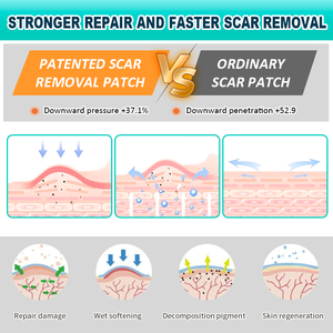 Bande adhésive cicatrisante en <span class=keywords><strong>silicone</strong></span> imperméable de 1,5 m – Produit de beauté et de soins personnels pour prévenir la prolifération des cicatrices - Product Image 4