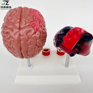 Maniquí de Demostración para la Enseñanza de Enfermedades Cardiovasculares y Cerebrovasculares Humanas, con Edad y Tamaño Real, en PVC Avanzado - Product Image 4
