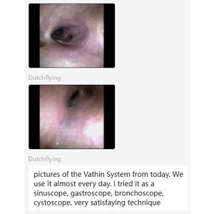 Vathin tek kullanımlık esnek veteriner endoskop bronkoskop tek kullanımlık Pet için esnek endoskop - Product Image 3