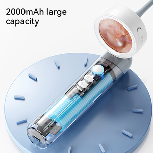 Herramienta Limpiadora para Removedor de Cerumen con Zoom 4X, 4 Luces LED y Pantalla de 1.38 Pulgadas, Otoscopio para Limpieza de Cera, Endoscopio Digital Visual con Cámara para Oído - Product Image 6