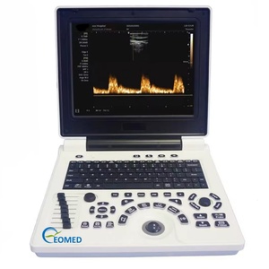 Échographe portable numérique complet à ultrasons pour usage vétérinaire et humain, fabriqué en Chine, à bas prix, avec PW, modèle BW20 - Product Image 1