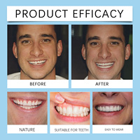 Offre Spéciale : Kit Dentaire Cosmétique Oralhoe en Silicone pour Prothèses Dentaires, Rétouches et Remplissages Dentaires, Appareil Orthodontique, Dents Artificielles