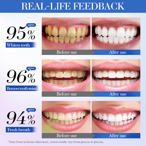 La Nueva Pasta de Dientes SADOER con Sabor a Limón y Menta, Blanquea, Elimina Manchas y Refresca el Aliento para Limpiar los Dientes - Product Image 6