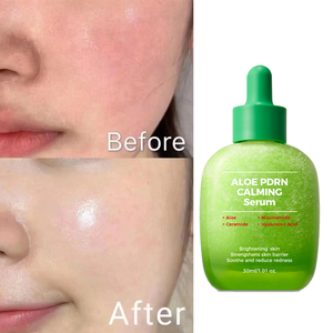 OEM Organic Hyaluronic Acid Calming Repairing Cica Moisturizing Face Serum Aloe Vera PDRN Serum - Product Image 1