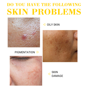 Yeni stil kore OEM/ODM organik hızlı beyazlatma yüz vücut cilt bakımı seti Anti-aging limon seti hyaluronik asit krem Serum güzellik - Product Image 3