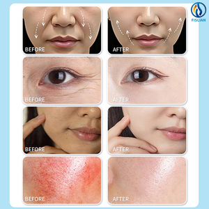 <span class=keywords><strong>Prix</strong></span> d'usine Machine Hydra 9-en-1 pour le lifting de la peau et la microdermabrasion, Équipement de beauté commercial - Product Image 6
