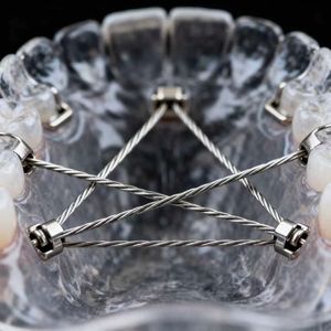 Chất lượng cao Nickel Titanium nitinol dây siêu đàn hồi hình dạng Bộ nhớ hợp kim thanh thanh với Nickel tấm kết thúc - Product Image 5