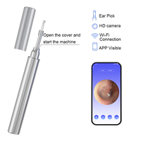 Otoscope numérique WiFi professionnel Ubetter, caméra pour nettoyer les oreilles, otoscope visuel électrique intelligent sans fil pour usage domestique