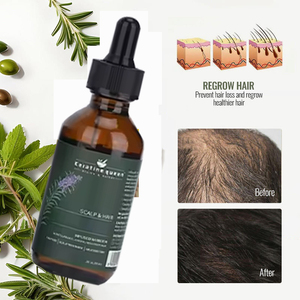 Aceite de crecimiento orgánico natural <span class=keywords><strong>para</strong></span> tratamiento <span class=keywords><strong>del</strong></span> <span class=keywords><strong>cabello</strong></span>, mezcla de hierbas, aceite de argán y Romero <span class=keywords><strong>para</strong></span> <span class=keywords><strong>el</strong></span> crecimiento <span class=keywords><strong>del</strong></span> <span class=keywords><strong>cabello</strong></span>, <span class=keywords><strong>beneficios</strong></span> anticaspa - Product Image 2