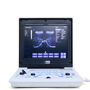 Beste prijs draagbare echografiemachine, veterinaire echografie, zwart-wit echografie scanner, ecografos veterinarios - Product Image 2
