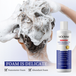 Shampooing anti-acné anti-démangeaisons à base de plantes 250ml extrait naturel de plante pour le <span class=keywords><strong>cuir</strong></span> <span class=keywords><strong>chevelu</strong></span> <span class=keywords><strong>psoriasis</strong></span> pellicules et contrôle de l'huile - Product Image 5