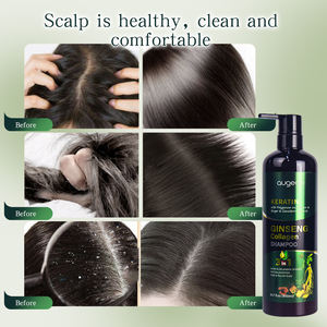 Champú para el Cabello Augeas al por Mayor, el Mejor Tratamiento Reparador con Proteína de Ginseng, Colágeno y Queratina - Product Image 4