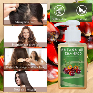 Shampoo Batana le plus vendu avec du romarin <span class=keywords><strong>pour</strong></span> <span class=keywords><strong>cheveux</strong></span> secs et abîmés, restaure la douceur et la brillance, réduit les frisottis - Product Image 5