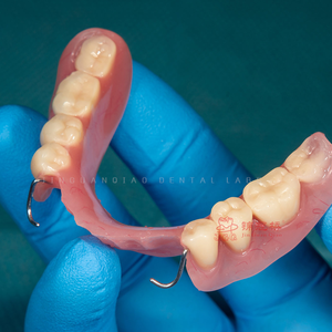 Rimovibile flessibile completa completa protesi tradizionale in acrilico denti finiti laboratorio di protesi dentale cina - Product Image 2