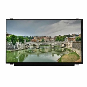 15,6 дюймов 30 PIN 1920x1080 FHD IPS TFT ЖК-экран дисплей Панель модуль для медицинской индустрии автомобильных оборудования для обеспечения безопасности - Product Image 1