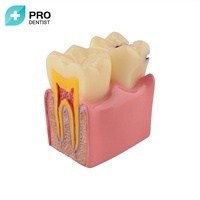 Modèle dentaire, Implants dentaires de modèle d'implant, Modèle dentaire de pont de couronne,