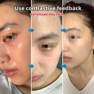 Masque Visage Anti-Acné à l'Acide Salicylique et Centella Asiatica de Madagascar, Réparateur Zéro Pores, Contrôle du Sébum, Minimiseur de Pores BHA - Product Image 3
