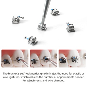 <span class=keywords><strong>Brackets</strong></span> Ortodontici Autoleganti <span class=keywords><strong>Roth</strong></span>/Mbt 022 con Tubi Buccali Joydental - Product Image 3