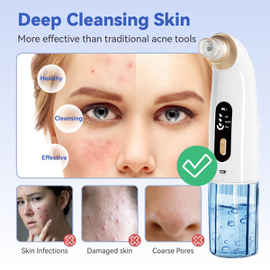 Xách tay mini da vắt lỗ chân lông Sữ<span class=keywords><strong>a</strong></span> Rử<span class=keywords><strong>a</strong></span> Mặt công cụ điện nhỏ bong bóng lỗ chân lông chân không loại bỏ mụn đầu đen - Product Image 4