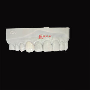 Riduzione minima dei denti di alta qualità in porcellana impiallacciatura dentale <span class=keywords><strong>Zirconia</strong></span> Ultra sottile sbiancamento dei denti - Product Image 1