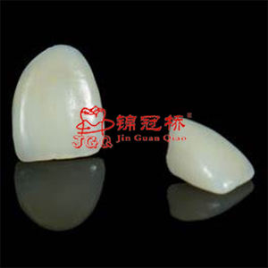 Apariencia Natural Impresión 3D Pfm Co-Cr Aleación Metal Cerámica Coronas dentales fijas comunes Puente Implantes Dentaduras postizas - Product Image 5