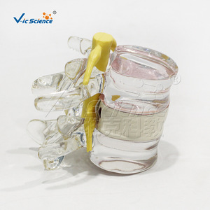 Modèle de démonstration de hernie discale lombaire, fabriqué en PVC respectueux de l'environnement, démonstration anatomique. - Product Image 1