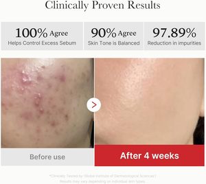 Medicube Pads Red Succinic Acid Pantheno Pad, Discos Exfoliantes con Ácido Succínico y Pantenol para Piel Propensa a Granos |   Niacinamida <span class=keywords><strong>No</strong></span> Comedogénica 70 Pads - Product Image 4