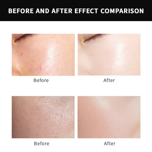 Sıcak satış OEM özel etiket koyun plasentası ekstresi yüz yağı Anti-Aging hücre yenileme sıkma nemlendirici beyazlatmak cilt bakımı serumu - Product Image 6