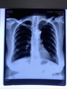 فيلم تغليف شفاف أزرق عالي الجودة مقاوم للماء وقابل للتمدد للاستخدام الطبي في أجهزة التصوير المقطعي بالأشعة المقطعية والرنين والأشعة السينية، سماكة 210 ميكرون، متوافق مع الحبر الصبغي - Product Image 2