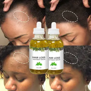 OEM Custom Brand Natural Organic Formula Nourishing Scalp Elixirs Hair Care Loss Oil Treatment Hair Growth Serum