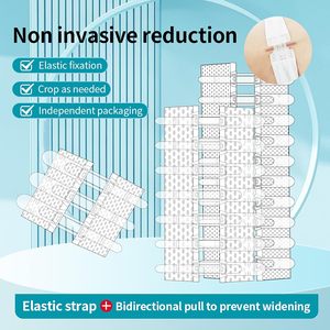 Tiras de Cierre de <span class=keywords><strong>Heridas</strong></span> Zip Stitch, Suturas, Vendaje Mariposa, Kit de Cierre de Laceraciones de Emergencia, <span class=keywords><strong>Adhesivo</strong></span> Médico Clase I (20x8cm) - Product Image 4