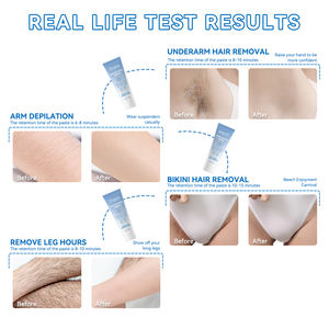 효과적인 겨드랑이 제모를위한 스킨 케어를위한 베스트 셀러 바디 제모 크림 - Product Image 2