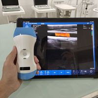 Ecógrafo de Bolsillo Portátil con Transductor Doppler Color JM-5CPL 3 en 1 para Uso Humano y Veterinario